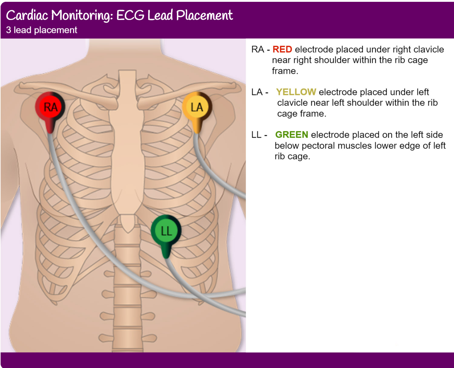 3 Lead ECG Placement YQF Medical Cable