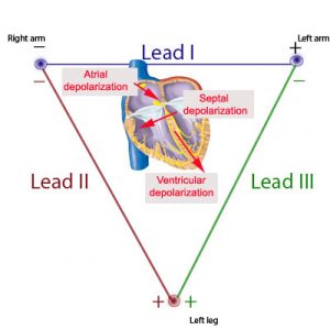 3 Leads ECG Cable and Placement | YQF Medical Cable